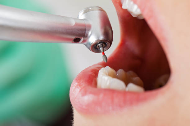 Best Emergency Tooth Extraction in Thorp, WI